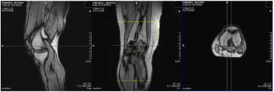 Radiographie du genou