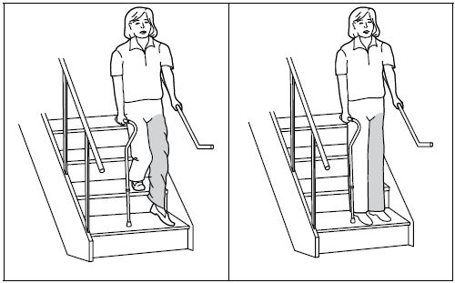 Arthroplastie du genou : Exercices