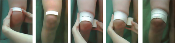 Bandage Genou - Technique de Bandage Genou