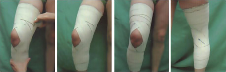 Bandage genou : douleur au genou