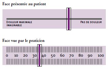 Douleur genou enfant