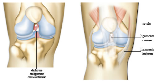 Ligamentoplastie : Chirurgie du genou