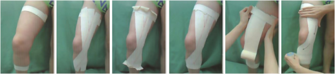 Bandage genou : douleur au genou Bandage genou : douleur au genou