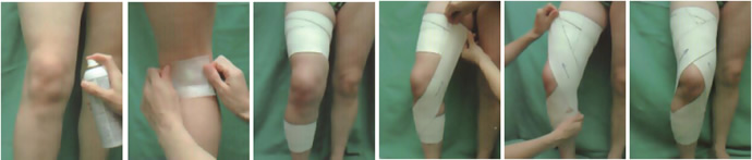 Bandage genou : douleur au genou Bandage genou : douleur au genou