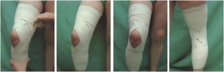 Bandage genou : douleur au genou Bandage genou : douleur au genou