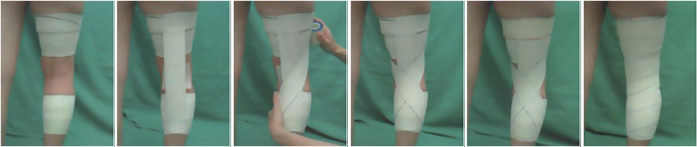 Bandage genou : douleur au genou Bandage genou : douleur au genou