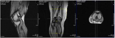 Radiographie du genou Radiographie du genou
