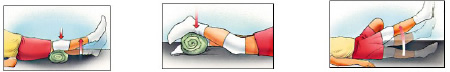 Rééducation du genou Rééducation du genou